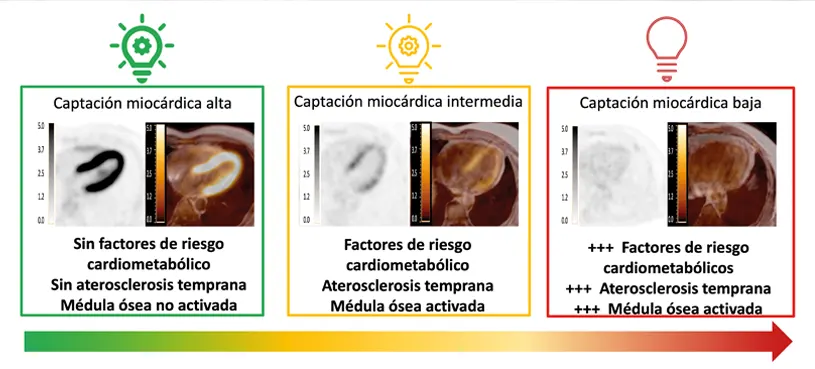 Factores como obesidad, hipertensión o dislipemia inducen una pérdida progresiva de energía en el corazón