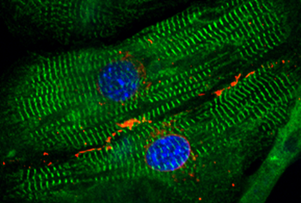 Force producing structures in cardiomyocytes