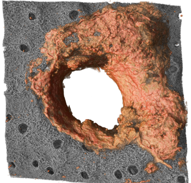 Reconstrucción 3D del anillo de colágeno (en naranja) producido por los neutrófilos que se forma alrededor de heridas en la piel.