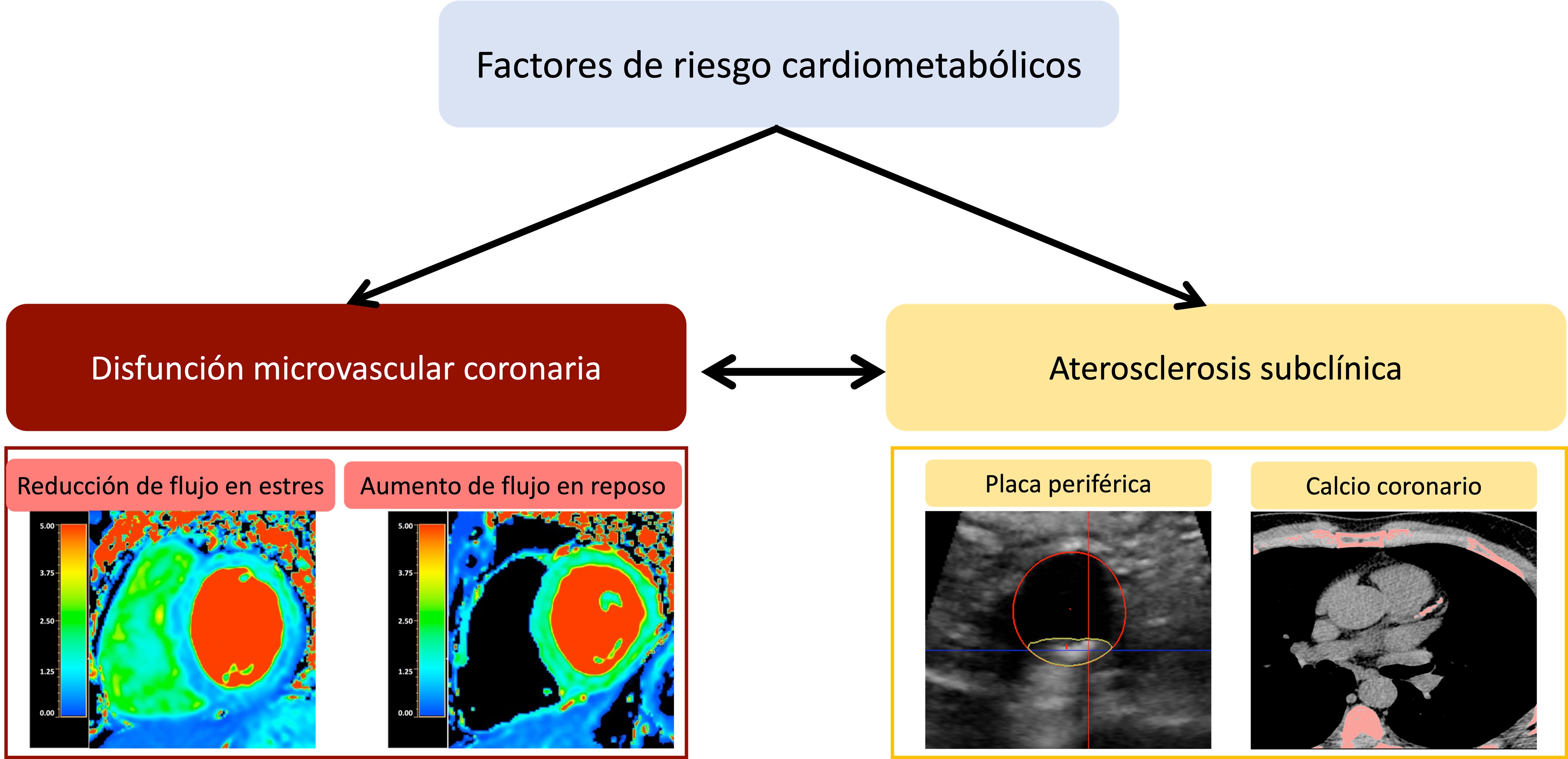 Los factores de riesgo cardiovascular (en particular los componentes del síndrome metabólico, la resistencia a la insulina y la diabetes) alteran la función microvascular coronaria y aumentan el riesgo de enfermedad aterosclerótica, la cual a su vez se asocia con alteraciones en la microcirculación coronaria.