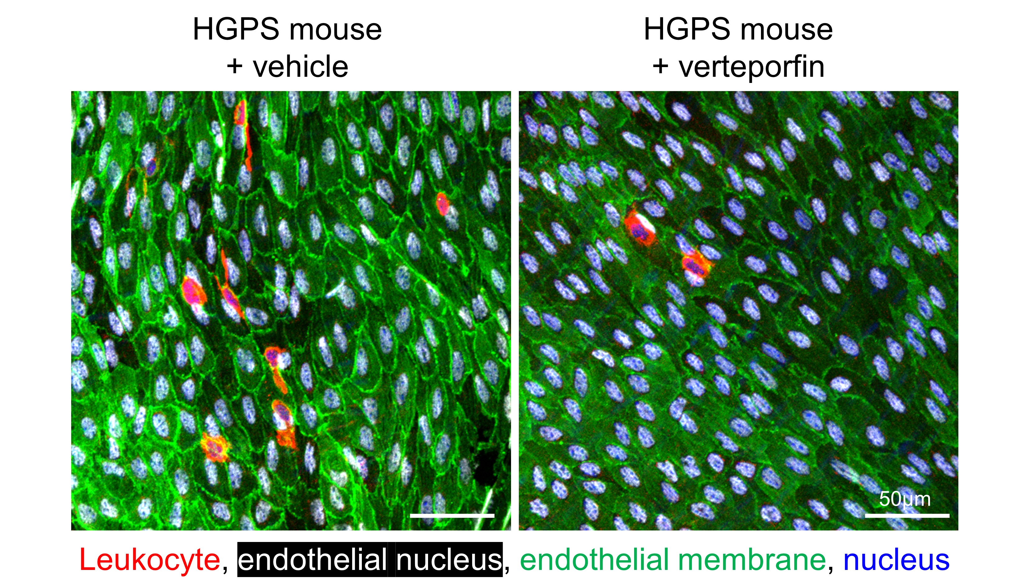 Immunofluorescence analysis of the aortic lumen in HGPS mice treated with vehicle or verteporfin. Endothelial cells are stained green (with the nuclei stained white), and leukocytes accumulating in the artery wall are stained red. 