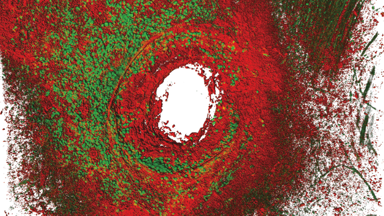 La imagen muestra cómo los neutrófilos (en verde) llegan alrededor de la herida y producen un anillo de colágeno (en rojo) que impide la entrada de agente patógenos o toxinas.