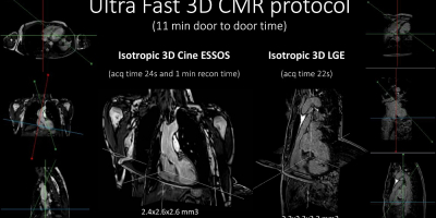 3D images obtained in anatomical, functional, and tissue characterization studies performed with the ultrafast cardiac magnetic resonance protocol
