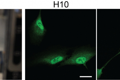 Biomaterial proteico, en naranja, colocado entre las pinzas de una máquina de tracción universal utilizada en la caracterización de propiedades mecánicas. Biomaterial y máquina diseñados en CNIC (izquierda). Imágenes de inmunofluorescencia de células de retina humana, dónde se muestra la localización nuclear y citoplásmatica de la proteína YAP (verde) en función de las propiedades mecánicas del material utilizado como matriz extracelular (derecha).